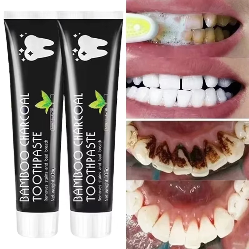 Teeth Whitening Charcoal - Pasta Gigi Pemutih Pasta Gigi Arang