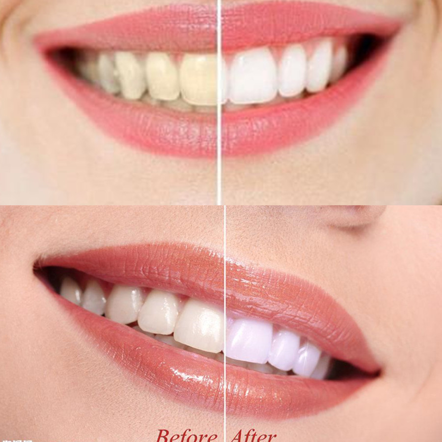 Arang Bambu Gigi Gigi Gigi Gig - Teeth Whitening Charcoal ulasan dan harga
