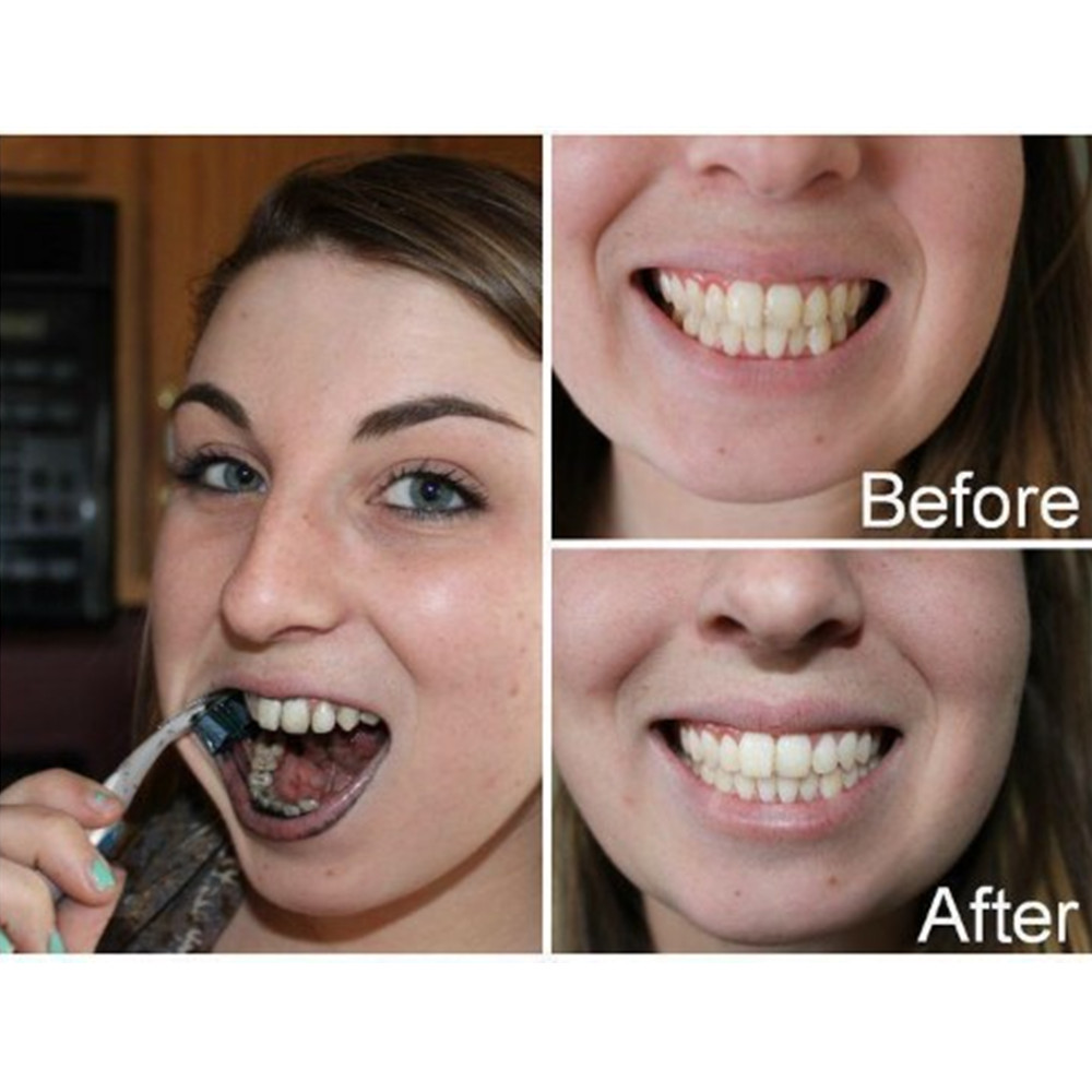 Arang Bambu Gigi Gigi Gigi Gig - Teeth Whitening Charcoal ulasan dan harga