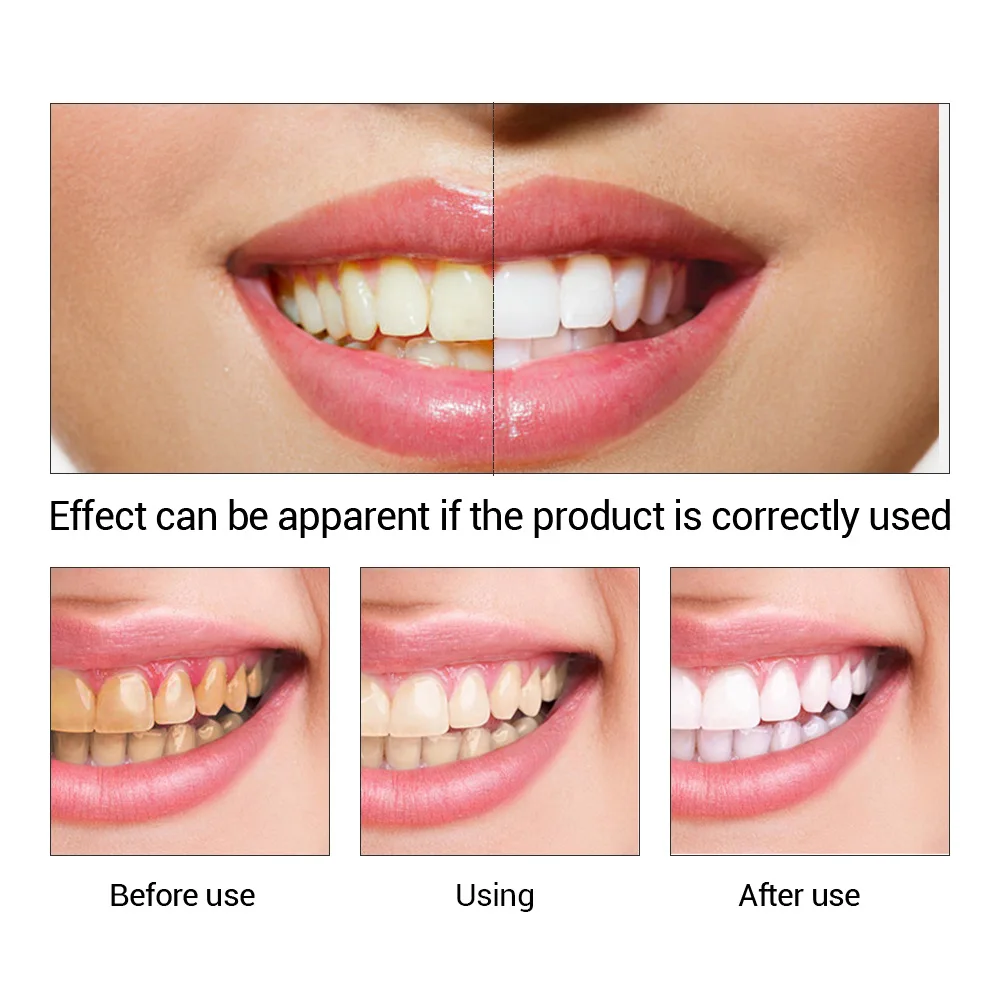 FTEENPLY Bubuk Esensi Pemutih  - Teeth Whitening Instant ulasan dan harga