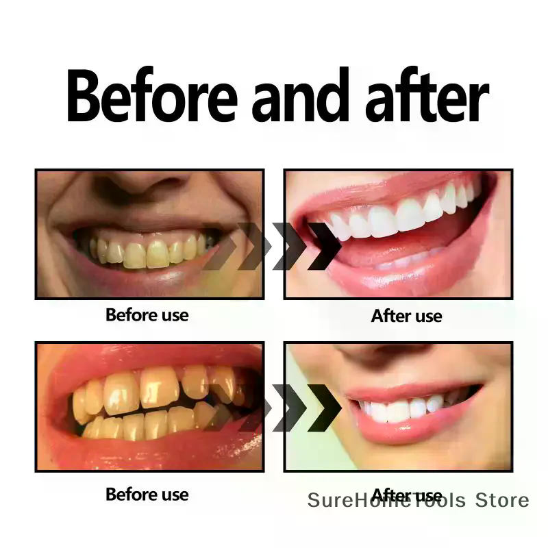 Bubuk Arang Bambu Untuk Gigi P - Teeth Whitening Charcoal ulasan dan harga