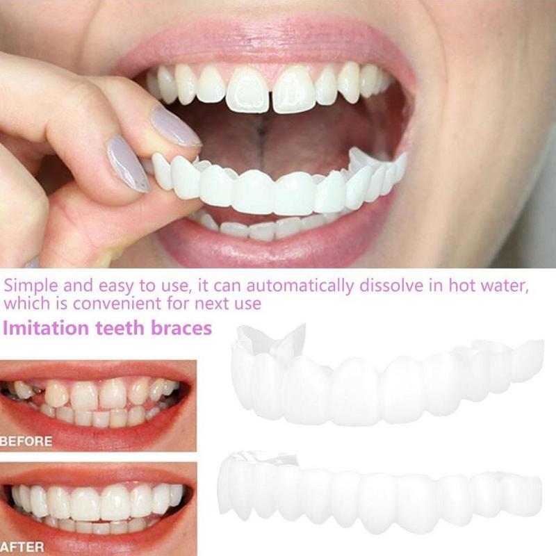 Veneer Gigi Snap On, Veneer Se - Teeth Whitening Instant ulasan dan harga