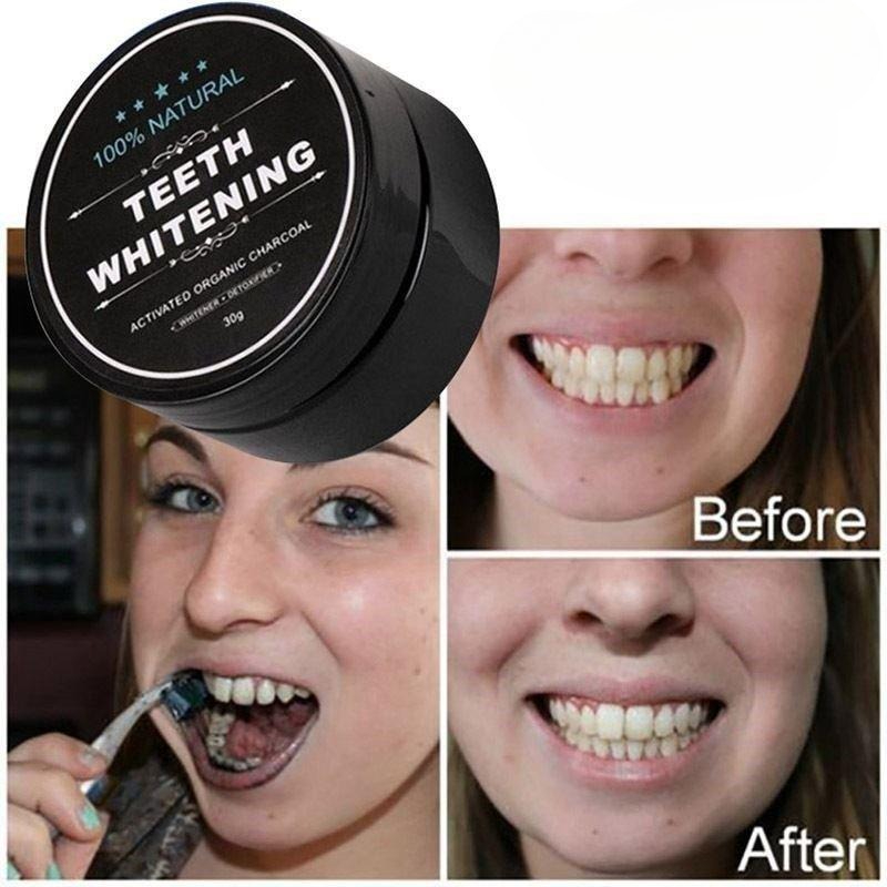 1 Kotak Bubuk Pemutih Gigi Ara - Teeth Whitening Charcoal ulasan dan harga