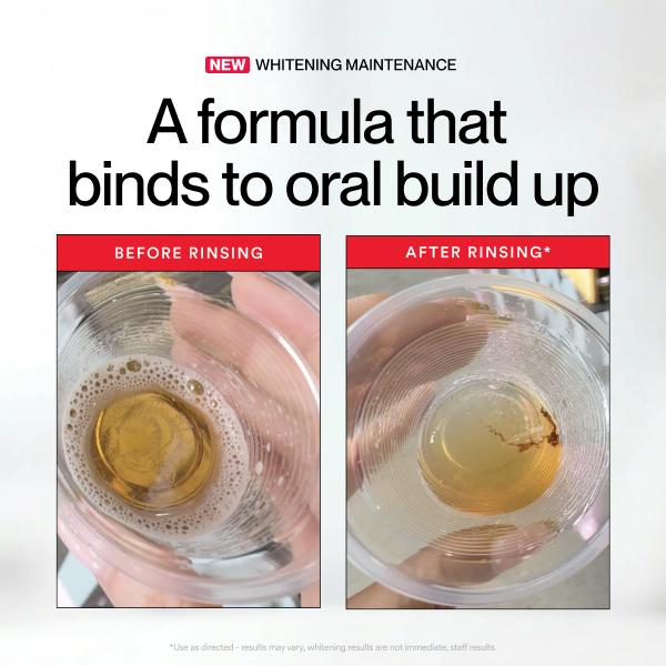 Hismile ID Whitening Stain Mou - Teeth Whitening Products ulasan dan harga