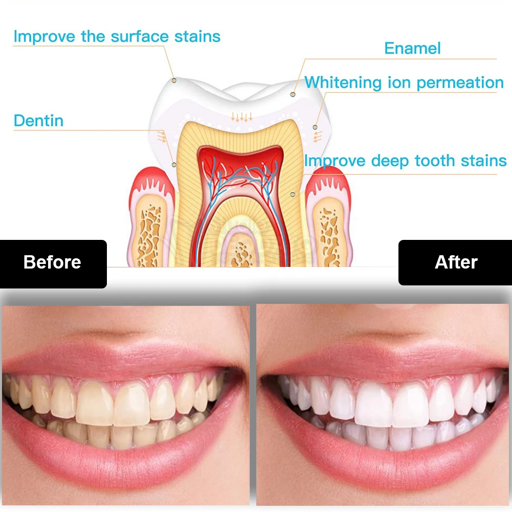 Kit pemutih gigi Mini 16 LED c - Teeth Whitening Light Kit ulasan dan harga