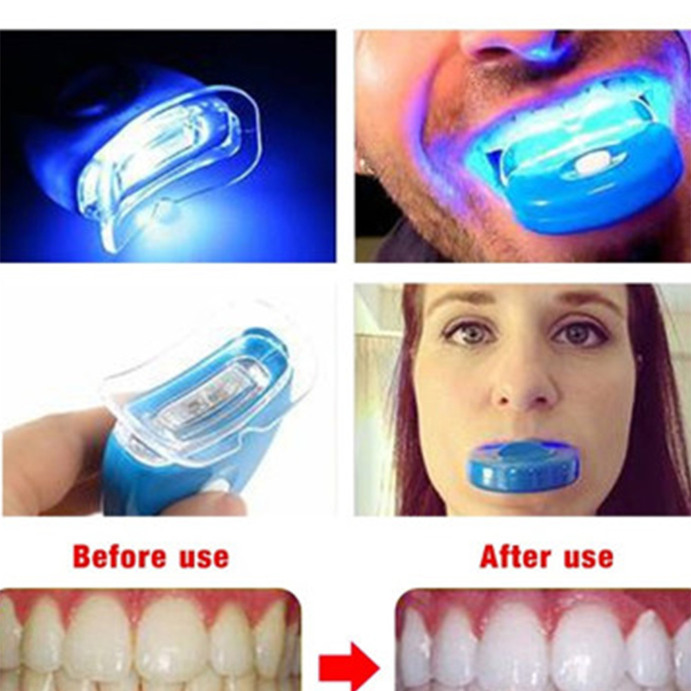 Baru Biru Led Akselerator Pemu - Teeth Whitening Uv Light ulasan dan harga